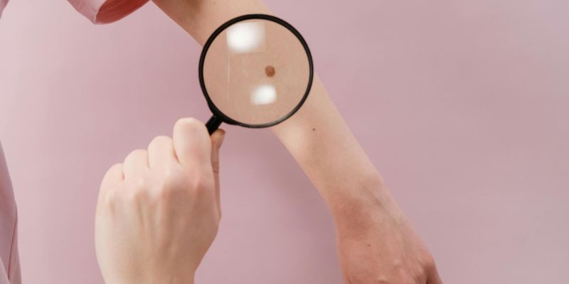 Nốt ruồi phong thủy và vận mệnh